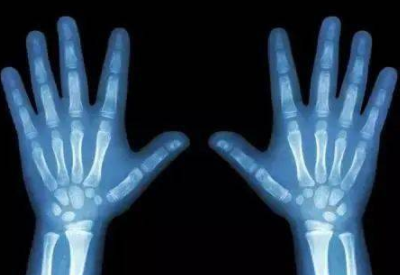 儿童生长发育测试仪厂家与您一起正确认识孩子骨龄 儿童生长发育测试仪厂家与您一起正确认识孩子骨龄